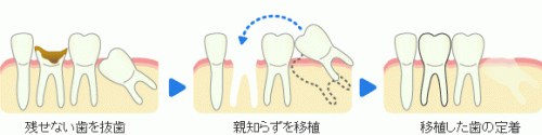 img_surgery05